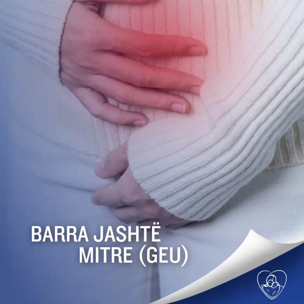 Barra jashtë mitrës