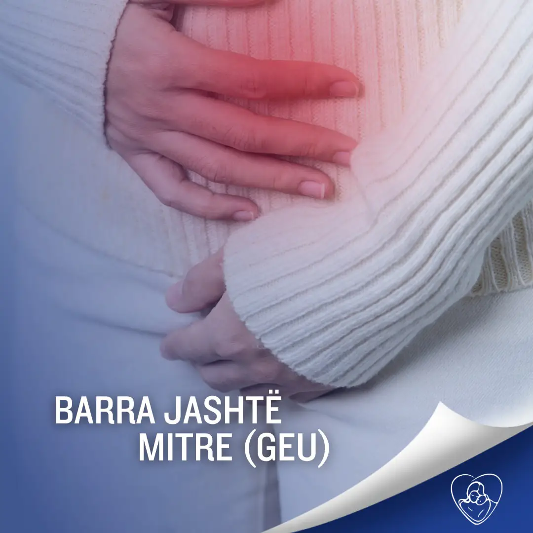 Barra jashtë mitrës