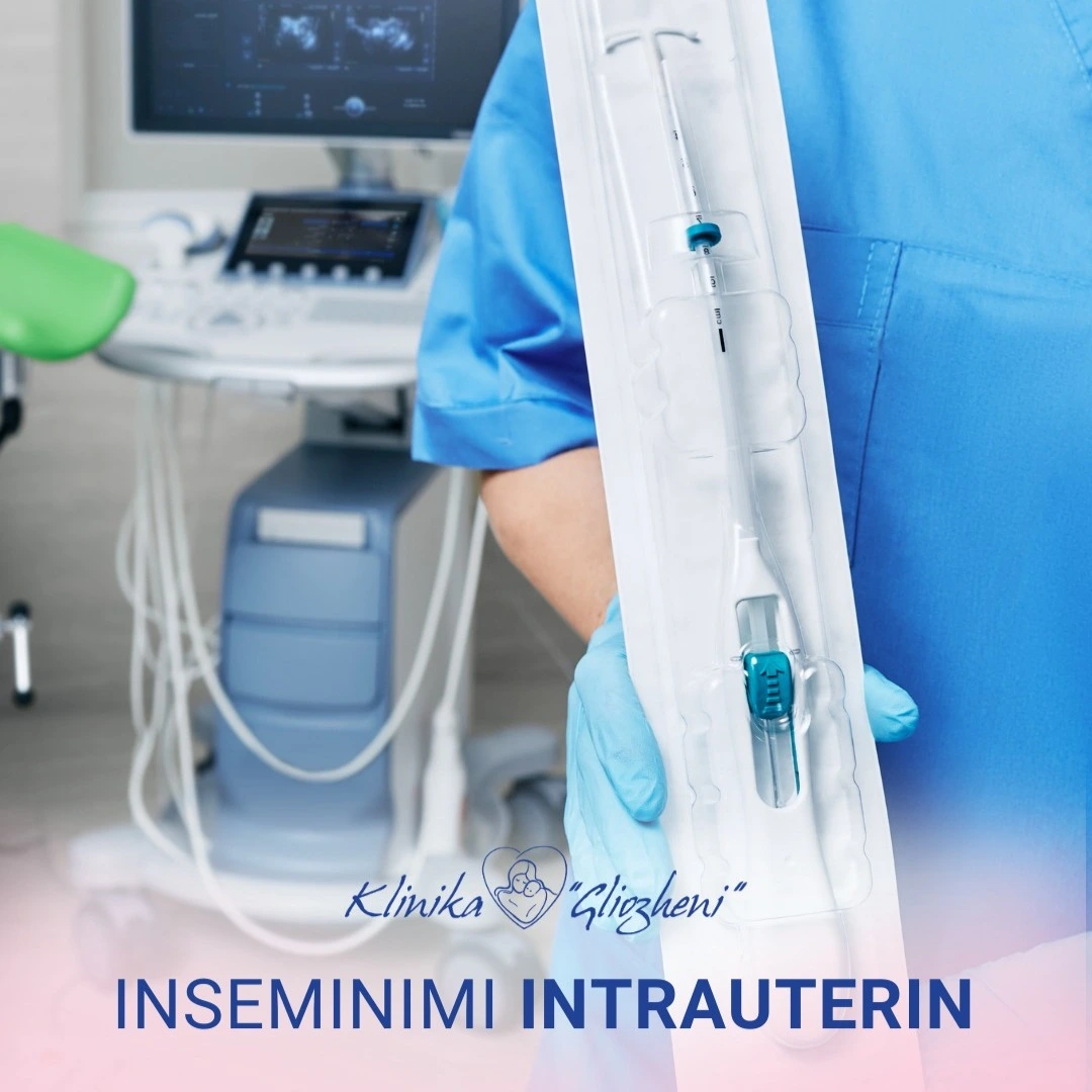 Inseminimi intrauterin